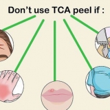 Die toepassing van 'n tca-skil