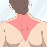 Herwinning van 'n trapezius-stam