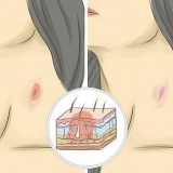 Gee 'n hickey