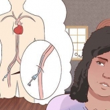 Herstel van 'n angiografie