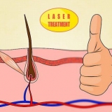 Haal die meeste uit laser-haarverwydering