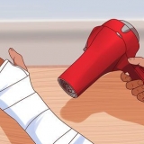 Jy krap as jy onder jou gips jeuk