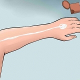 Smeer lotion op jou rug