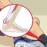 Behandeling van tendonitis