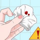 Stop rektale bloeding
