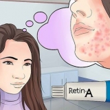 Gebruik retinol