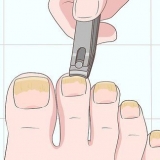 Behandeling van swamnaels