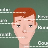 Los sinusitis op