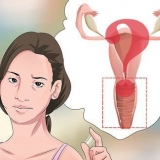 Diagnose van vaginale afskeiding