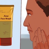 Raak ontslae van 'n puisie met aloe vera gel