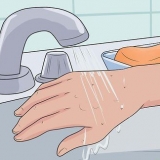 Behandeling van vlooibyte