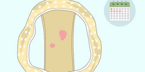 Herkenning van abnormale bloeding tussen menstruasieperiodes