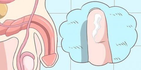 Herkenning van die simptome van chlamydia (vir mans)