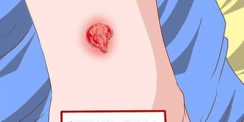 Herken die simptome van 'n mrsa-infeksie