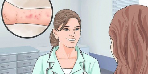 Verligting van die simptome van spongiotiese dermatitis