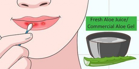 Genees sonverbrande lippe