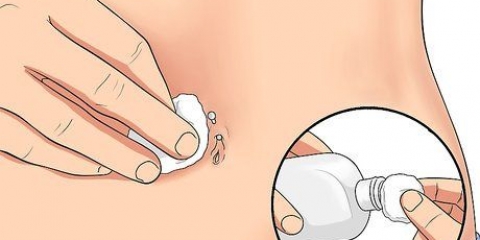 Behandeling van 'n geïrriteerde naeltjiepiercing