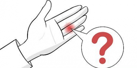Behandeling van 'n gekneusde vinger