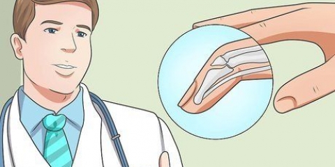 Behandel 'n hamervinger met 'n spalk