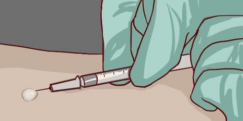 Lees 'n veltoets vir tuberkulose