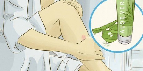 Behandeling van 'n keloid