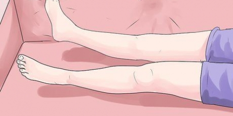 Een milde hematoom self behandelen