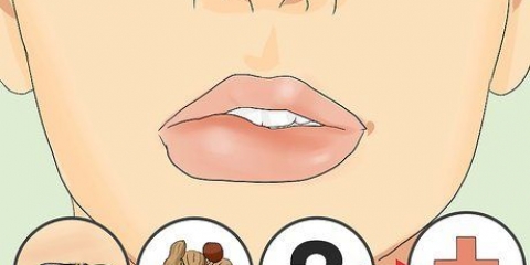 Genees 'n geswelde lip