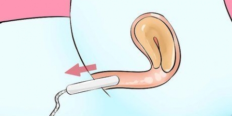 Verwyder 'n tampon