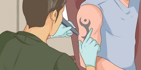 Verwyder 'n tatoeëermerk