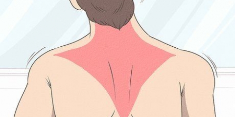 Herwinning van 'n trapezius-stam