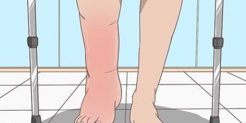 Behandeling van swelling