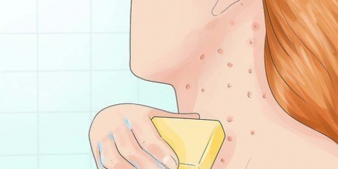 Behandeling van follikulitis