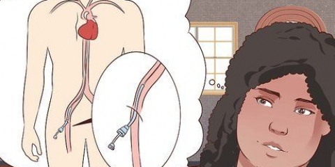 Herstel van 'n angiografie