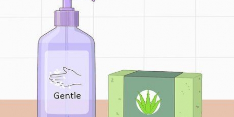 Behandeling van gebarste vingers