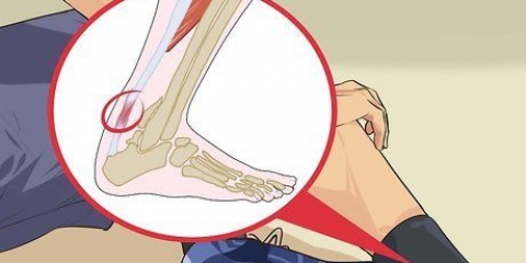 Behandeling van tendonitis