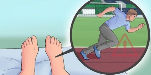 Behandeling van plantar fasciitis