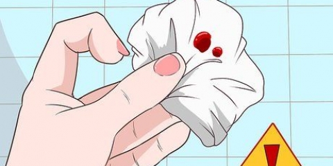 Stop rektale bloeding