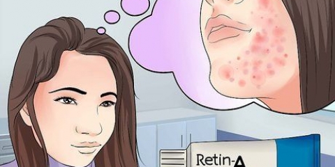 Gebruik retinol