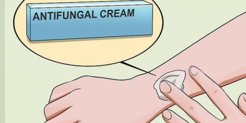 Behandel ringwurm