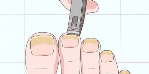Behandeling van swamnaels