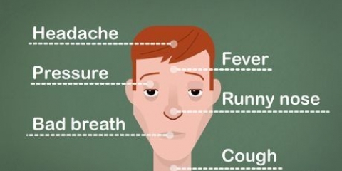 Los sinusitis op