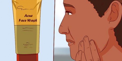 Raak ontslae van 'n puisie met aloe vera gel