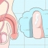Herkenning van die simptome van chlamydia (vir mans)