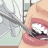 Behandeling van 'n dik lip