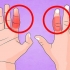Behandel 'n gebreekte vinger