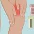 Behandeling van tendonitis in die quadriceps