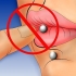 Maak 'n piercing skoon