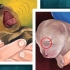Gesondheidsprobleme by pasgebore puppy's herkennen