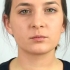 Wend lipomlyner aan