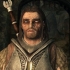 Genesende lycanthropy in skyrim